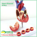 HEART05(12481) Life-size Human Heart Anatomy in 2 part with 4 Pieces Thrombosis Cross Section ,Anatomy Models > Heart Models